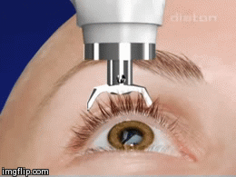 Diaton Tonometer - Tonometry through eyelid and sclera, for glaucoma testing