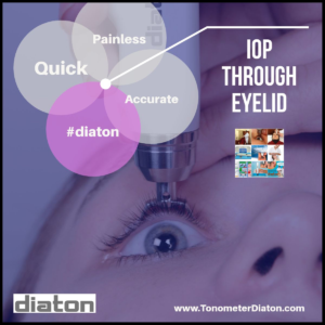 diaton tonometer measure IOP with lenses on the eye