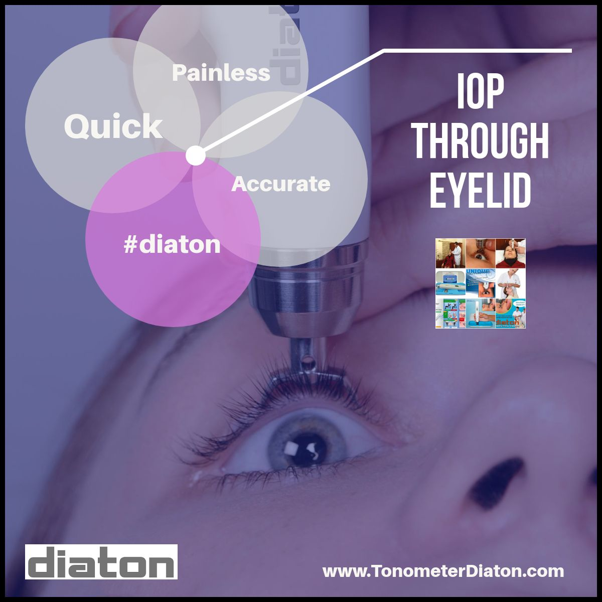 Eye Tonometer Diaton