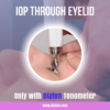 Diaton Tonometer IOP through eyelid