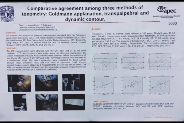 COMPARATIVE AGREEMENT AMONG THREE METHODS OF TONOMETRY: GOLDMANN APPLANATION, DIATON TRANSPALPEBRAL, AND DYNAMIC CONTOUR